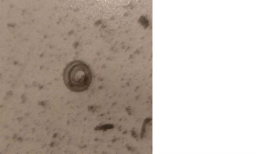 Originalaufnahme der positiven Probe; eingerollte Trichine.
Foto: Landkreis Rotenburg (Wümme)