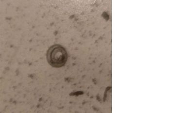 Originalaufnahme der positiven Probe; eingerollte Trichine.
Foto: Landkreis Rotenburg (Wümme)