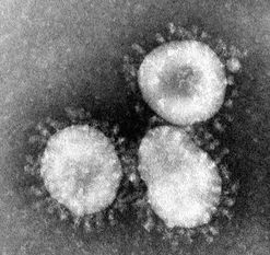 Viele Mitbürger*innen befürchten eine Ansteckung mit dem Coronavirus SARS-CoV-2. Mit einer guten Händehygiene und Nies-und Hustenetikette kann man sich und andere schützen. Foto: Wikipedia