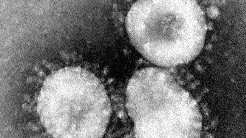 Viele Mitbürger*innen befürchten eine Ansteckung mit dem Coronavirus SARS-CoV-2. Mit einer guten Händehygiene und Nies-und Hustenetikette kann man sich und andere schützen. Foto: Wikipedia