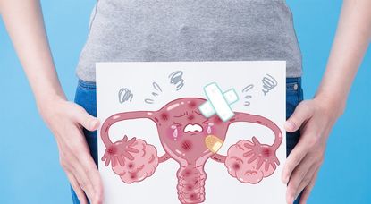 Die gynäkologische Erkrankung Endometriose verursacht den Betroffenen häufig starke Schmerzen und hat meist weitreichende Auswirkungen auf das gesamte Leben Foto: Adobe Stock/ryanking999