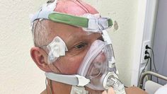 Unser Autor mit den Messgeräten am zweiten Tag im Schlaflabor. Wenn die Schlafmaske zuhause genutzt wird, ist der Oberkörper nicht verkabelt – es wird im täglichen Gebrach also lediglich die Maske genutzt.