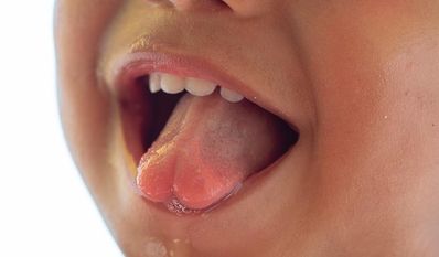 Speichel ist ein echtes Multitalent in unserem Mund - er macht z.B. Sprechen erst möglich.